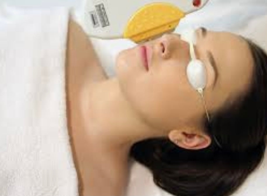 IPL Hair removal Full Face 3 sessions