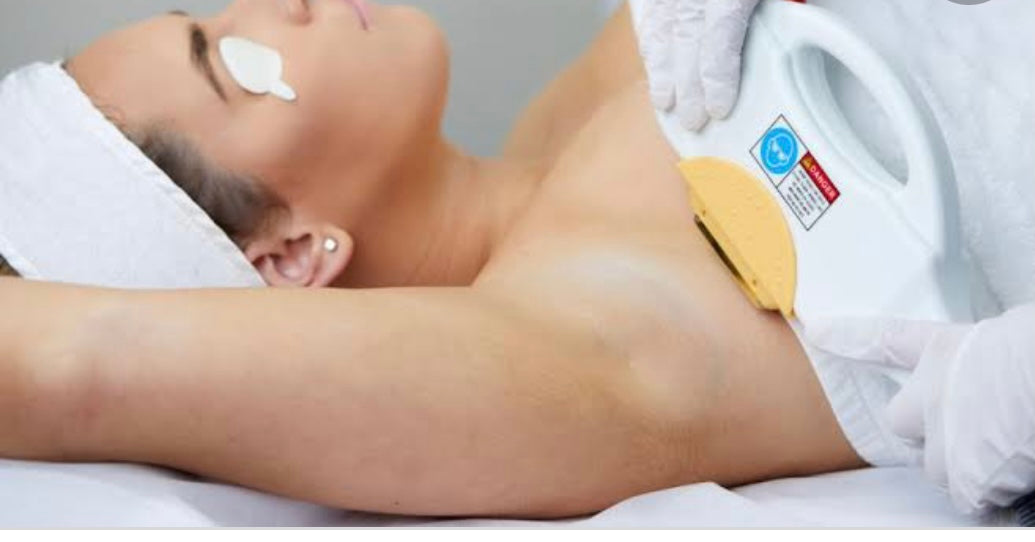 IPL Hair removal Underarms 3 sessions