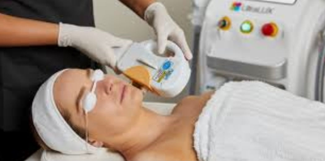 IPL Hair removal Lip 3 sessions